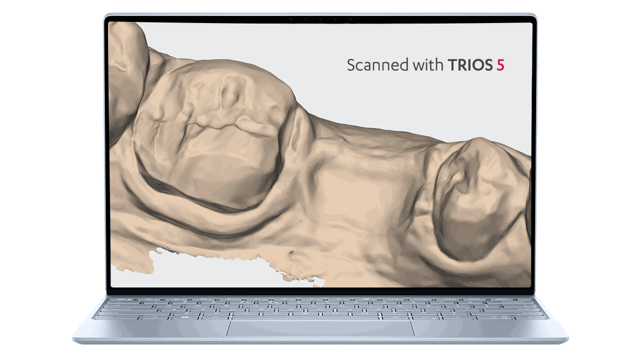 3Shape_Trios_6_Schweiz