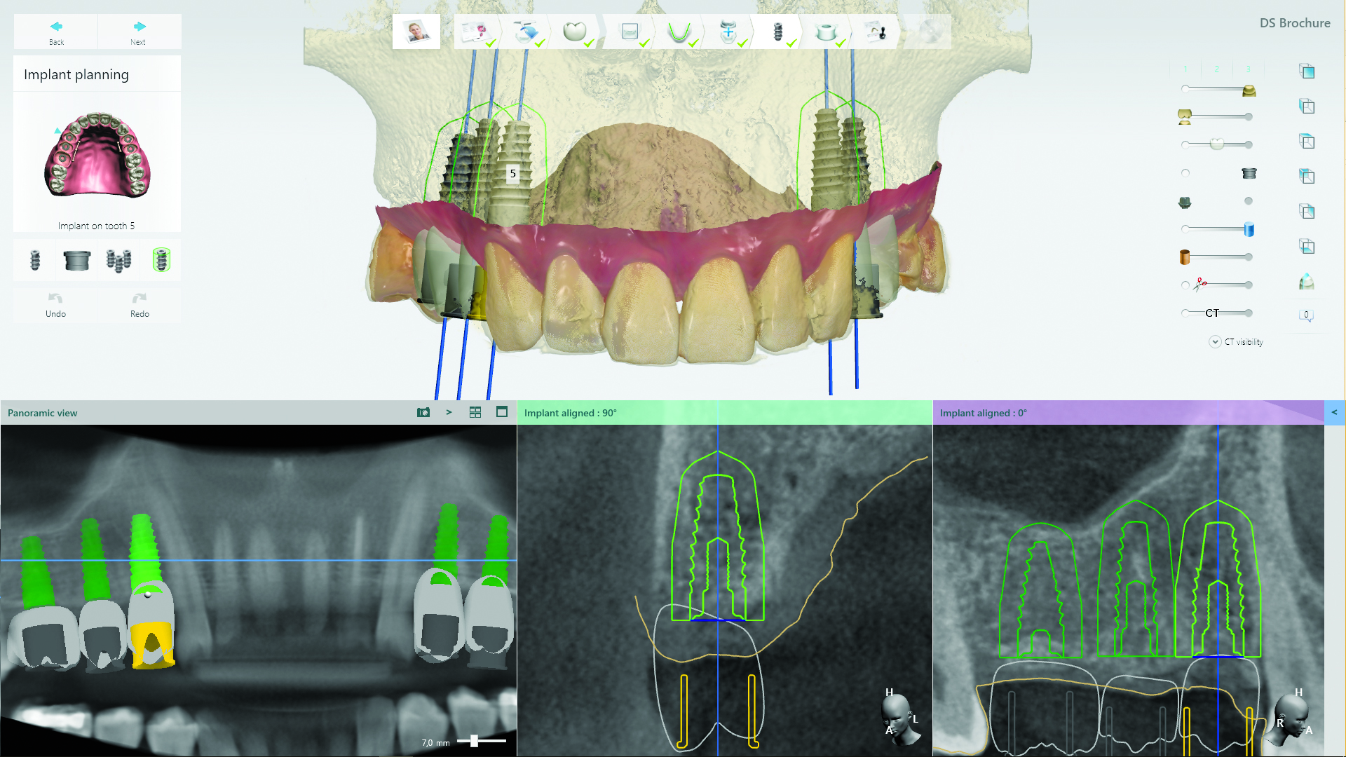 Dental-system-dental-axess